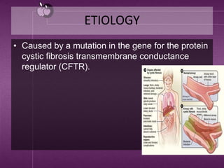 ETIOLOGY
• Caused by a mutation in the gene for the protein
cystic fibrosis transmembrane conductance
regulator (CFTR).
 