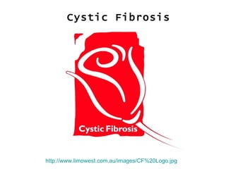Cystic Fibrosis http://www.limowest.com.au/images/CF%20Logo.jpg   