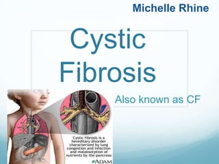Michelle Rhine Cystic Fibrosis Also known as CF 