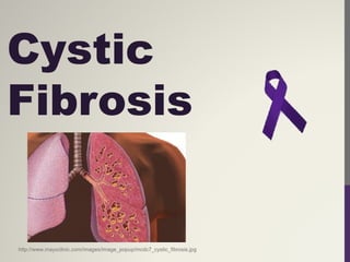 Cystic
Fibrosis


http://www.mayoclinic.com/images/image_popup/mcdc7_cystic_fibrosis.jpg
 