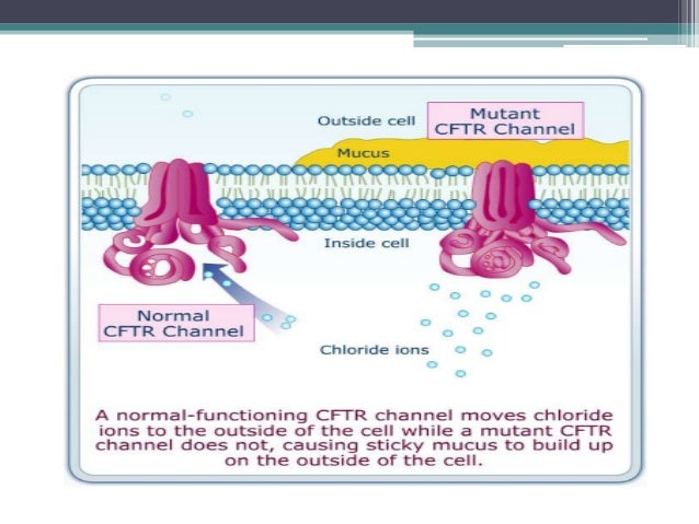 an overview of the inherited disease cystic fibrosis Company overview cystic fibrosis ireland • cystic fibrosis is a genetically inherited disease affecting mainly the lungs and the digestive system. an overview of the inherited disease cystic fibrosis Company overview cystic fibrosis ireland • cystic fibrosis is a genetically inherited disease affecting mainly the lungs and the digestive system.