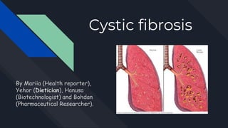 Cystic fibrosis
By Mariia (Health reporter),
Yehor (Dietician), Hanusa
(Biotechnologist) and Bohdan
(Pharmaceutical Researcher).
 
