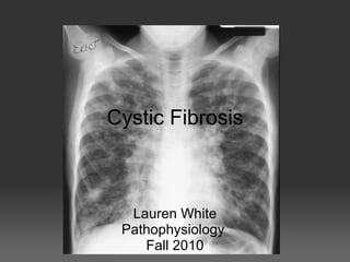 Cystic Fibrosis
Lauren White
Pathophysiology
Fall 2010
 