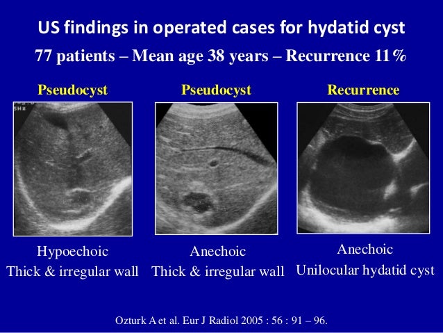 Cystic liver lesions - An ultrasound perspective
