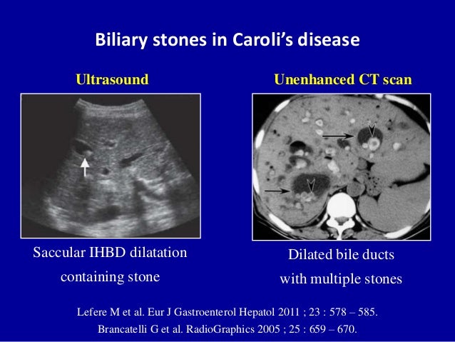 Cystic liver lesions - An ultrasound perspective