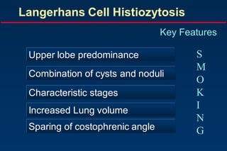 Langerhans Cell Histiozytosis
Key Features
Upper lobe predominance
Combination of cysts and noduli
Characteristic stages
Increased Lung volume
Sparing of costophrenic angle
S
M
O
K
I
N
G
 