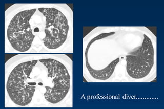 A professional diver.............
 