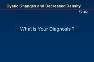 What is Your Diagnosis ?
Cystic Changes and Decreased Density
Quiz
 
