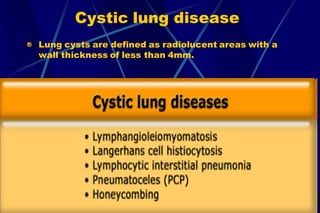 Cystic lung disease
Lung cysts are defined as radiolucent areas with a
wall thickness of less than 4mm.
 