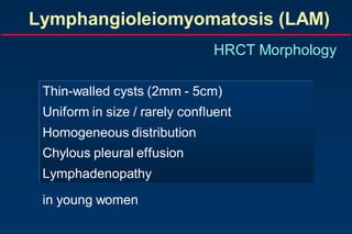 Lymphangioleiomyomatosis (LAM)
HRCT Morphology
Thin-walled cysts (2mm - 5cm)
Uniform in size / rarely confluent
Homogeneous distribution
Chylous pleural effusion
Lymphadenopathy
in young women
 