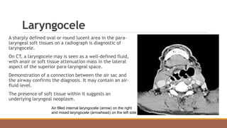 Laryngocele
A sharply defined oval or round lucent area in the para-
laryngeal soft tissues on a radiograph is diagnostic of
laryngocele.
On CT, a laryngocele may is seen as a well-defined fluid,
with anair or soft tissue attenuation mass in the lateral
aspect of the superior para-laryngeal space.
Demonstration of a connection between the air sac and
the airway confirms the diagnosis. It may contain an air-
fluid level.
The presence of soft tissue within it suggests an
underlying laryngeal neoplasm.
Air filled internal laryngocele (arrow) on the right
and mixed laryngocele (arrowhead) on the left side
 