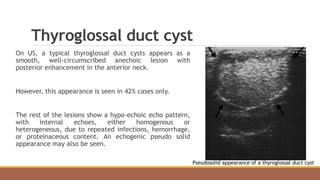 Thyroglossal duct cyst
On US, a typical thyroglossal duct cysts appears as a
smooth, well-circumscribed anechoic lesion with
posterior enhancement in the anterior neck.
However, this appearance is seen in 42% cases only.
The rest of the lesions show a hypo-echoic echo pattern,
with internal echoes, either homogenous or
heterogeneous, due to repeated infections, hemorrhage,
or proteinaceous content. An echogenic pseudo solid
appearance may also be seen.
Pseudosolid appearance of a thyroglossal duct cyst
 