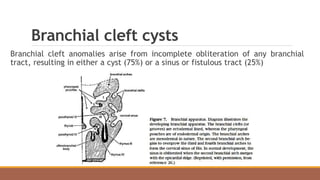 Branchial cleft cysts
Branchial cleft anomalies arise from incomplete obliteration of any branchial
tract, resulting in either a cyst (75%) or a sinus or fistulous tract (25%)
 