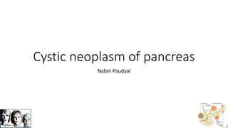 Cystic neoplasm of pancreas
Nabin Paudyal
 