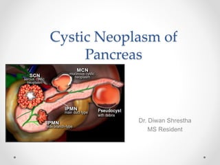 Cystic Neoplasm of
Pancreas
Dr. Diwan Shrestha
MS Resident
 