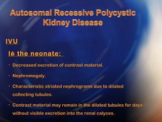 In the neonate:In the neonate:
• Decreased excretion of contrast material.Decreased excretion of contrast material.
• Nephromegaly.Nephromegaly.
• Characteristic striated nephrograms due to dilatedCharacteristic striated nephrograms due to dilated
collecting tubules.collecting tubules.
• Contrast material may remain in the dilated tubules for daysContrast material may remain in the dilated tubules for days
without visible excretion into the renal calyces.without visible excretion into the renal calyces.
IVUIVU
::
 