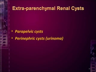 35
• Parapelvic cysts
• Perinephric cysts (urinoma)
 