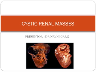 CYSTIC RENAL MASSES
PRESENTOR : DR NAVNI GARG
 