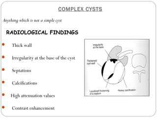 COMPLEX CYSTS
Anything which is not a simple cyst
RADIOLOGICAL FINDINGS
 Thick wall
 Irregularity at the base of the cyst
 Septations
 Calcifications
 High attenuation values
 Contrast enhancement
 