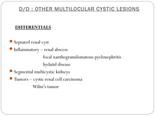 D/D : OTHER MULTILOCULAR CYSTIC LESIONS
DIFFERENTIALS
Septated renal cyst
Inflammatory – renal abscess
focal xanthogranulomatous pyelonephritis
hydatid disease
Segmental multicystic kidneys
Tumors – cystic renal cell carcinoma
Wilm’s tumor
 