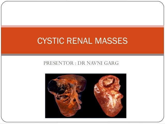 Computed tomography findings for a mesenteric cyst. Mul ...
