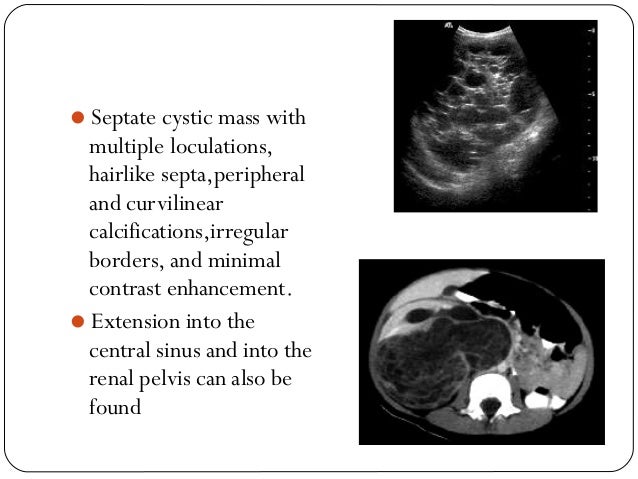 The Next Quiet Voice How Broken Dreams and Alcoholism Can Lead to Spiritual Freedom