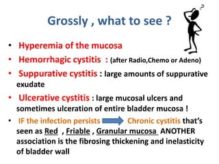 Simple Cystitis Cystitis made easy | PPTX