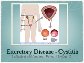 Excretory Disease - Cystitis
By:Navjeet andVandana Period 1 Biology 12

 