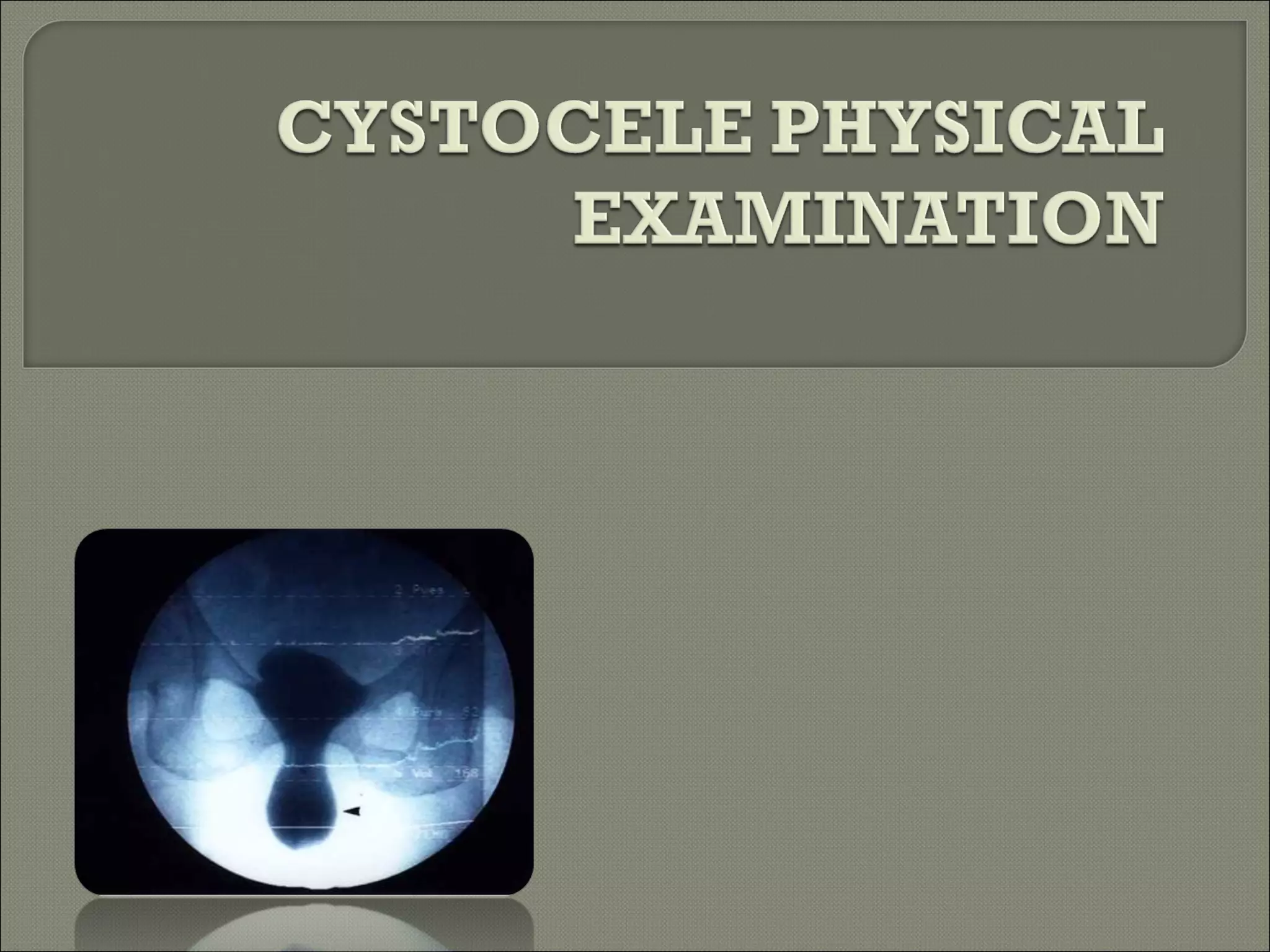 Cystocele physical examination PPT