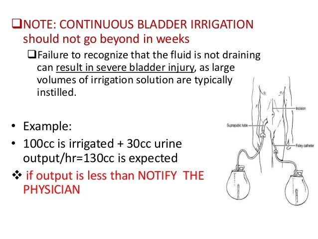 cystoclysis bladder irrigation continuous bladder irrigation