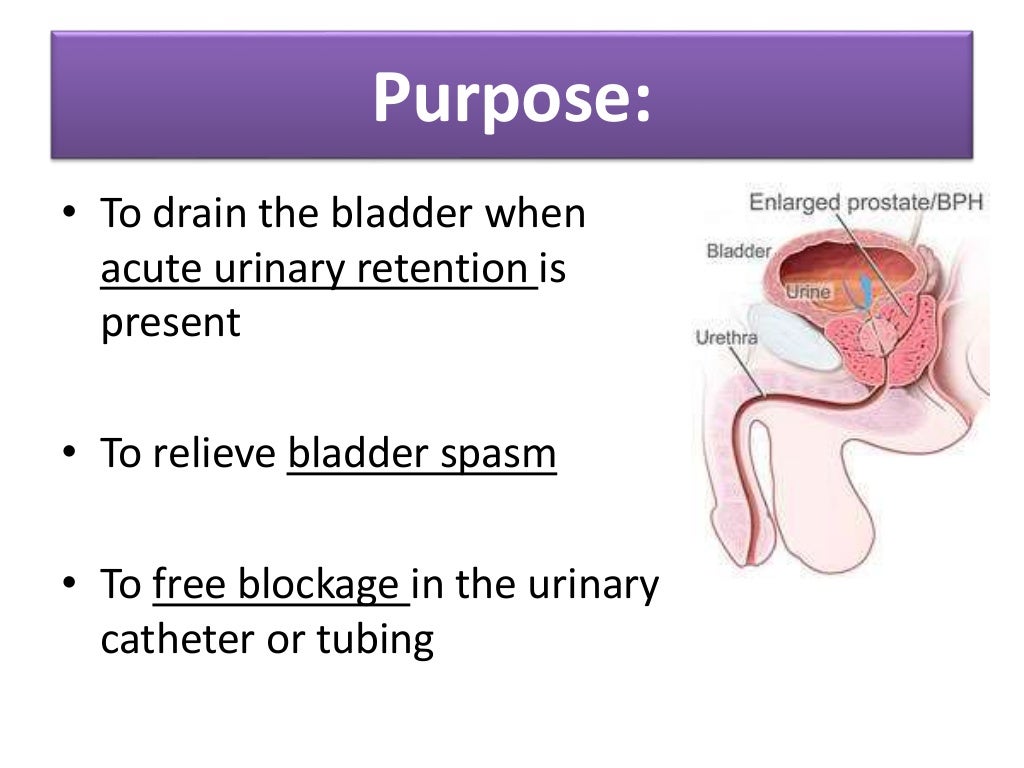 Cystoclysis bladder irrigation