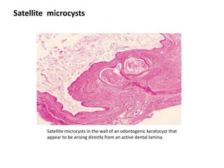 Microcysts Rces Cystofjaw rkv.. | PPTX