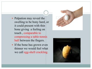 Cyst of jawsnet | PPTX