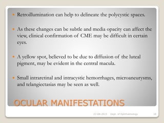 OCULAR MANIFESTATIONS
 Retroillumination can help to delineate the polycystic spaces.
 As these changes can be subtle and media opacity can affect the
view, clinical confirmation of CME may be difficult in certain
eyes.
 A yellow spot, believed to be due to diffusion of the luteal
pigment, may be evident in the central macula.
 Small intraretinal and intracystic hemorrhages, microaneurysms,
and telangiectasias may be seen as well.
22-08-2015 Dept. of Ophthalmology 18
 