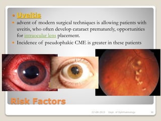 Risk Factors
 Uveitis
 advent of modern surgical techniques is allowing patients with
uveitis, who often develop cataract prematurely, opportunities
for intraocular lens placement.
 Incidence of pseudophakic CME is greater in these patients
22-08-2015 Dept. of Ophthalmology 38
 
