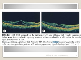 22-08-2015 Dept. of Ophthalmology 59
 