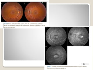 22-08-2015 Dept. of Ophthalmology 70
 