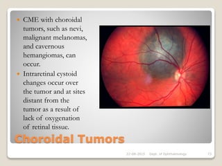 Choroidal Tumors
 CME with choroidal
tumors, such as nevi,
malignant melanomas,
and cavernous
hemangiomas, can
occur.
 Intraretinal cystoid
changes occur over
the tumor and at sites
distant from the
tumor as a result of
lack of oxygenation
of retinal tissue.
22-08-2015 Dept. of Ophthalmology 73
 