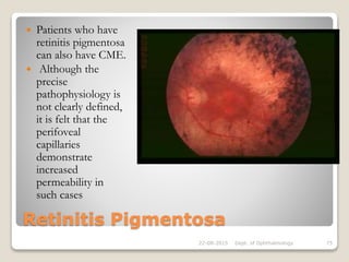 Retinitis Pigmentosa
 Patients who have
retinitis pigmentosa
can also have CME.
 Although the
precise
pathophysiology is
not clearly defined,
it is felt that the
perifoveal
capillaries
demonstrate
increased
permeability in
such cases
22-08-2015 Dept. of Ophthalmology 75
 