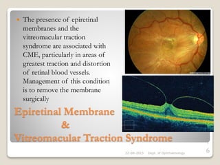 Epiretinal Membrane
&
Vitreomacular Traction Syndrome
 The presence of epiretinal
membranes and the
vitreomacular traction
syndrome are associated with
CME, particularly in areas of
greatest traction and distortion
of retinal blood vessels.
Management of this condition
is to remove the membrane
surgically
22-08-2015 Dept. of Ophthalmology
7
6
 