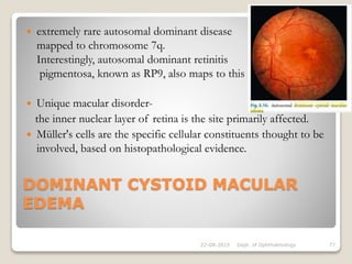 DOMINANT CYSTOID MACULAR
EDEMA
 extremely rare autosomal dominant disease
mapped to chromosome 7q.
Interestingly, autosomal dominant retinitis
pigmentosa, known as RP9, also maps to this region.
 Unique macular disorder-
the inner nuclear layer of retina is the site primarily affected.
 Müller's cells are the specific cellular constituents thought to be
involved, based on histopathological evidence.
22-08-2015 Dept. of Ophthalmology 77
 