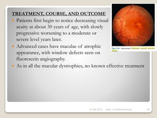 TREATMENT, COURSE, AND OUTCOME
 Patients first begin to notice decreasing visual
acuity at about 30 years of age, with slowly
progressive worsening to a moderate or
severe level years later.
 Advanced cases have maculae of atrophic
appearance, with window defects seen on
fluorescein angiography.
 As in all the macular dystrophies, no known effective treatment
22-08-2015 Dept. of Ophthalmology 80
 