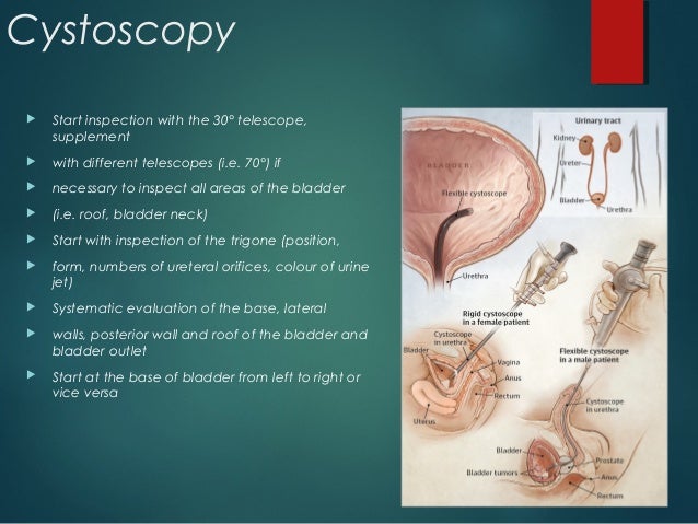 CYSTOSCOPY cystoscopy