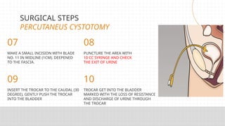 OPTEK ILMIAH CYSTOTOMY BEDAH UROLOGI.pptx