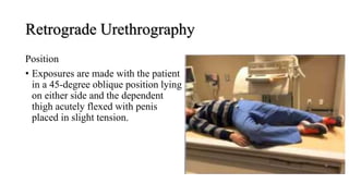 Retrograde Urethrography
Position
• Exposures are made with the patient
in a 45-degree oblique position lying
on either side and the dependent
thigh acutely flexed with penis
placed in slight tension.
 
