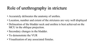 Role of urethrography in stricture
• Accurately delineates the anatomy of urethra.
• Location, number and extent of the strictures are very well displayed
• Delineation of the bladder neck and urethra is best achieved on the
MCU in the oblique projection.
• Secondary changes in the bladder.
• To demonstrate the VUR
• Visualization of any associated fistulas.
 