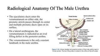 Radiological Anatomy Of The Male Urethra
• The ejaculatory ducts enter the
verumontanum on either side, the
prostatic utricle passes through its center,
and multiple prostatic ducts open on its
surface.
• On a lateral urethrogram, the
verumontanum is indicated as an oval
filling defect in the posterior urethra.
• The verumontanum is the only constant
landmark in the male urethra.
 