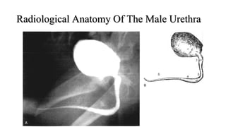 Radiological Anatomy Of The Male Urethra
 