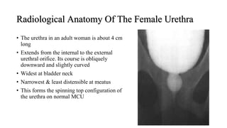 Radiological Anatomy Of The Female Urethra
• The urethra in an adult woman is about 4 cm
long
• Extends from the internal to the external
urethral orifice. Its course is obliquely
downward and slightly curved
• Widest at bladder neck
• Narrowest & least distensible at meatus
• This forms the spinning top configuration of
the urethra on normal MCU
 