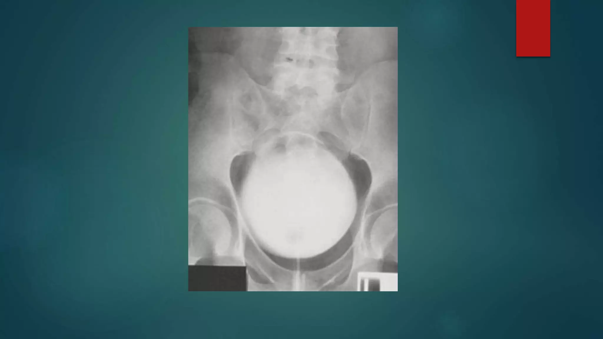 Cystourethrography - Lecture.pptx